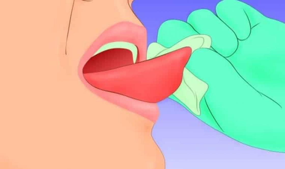 Mida teha, kui laps või täiskasvanu hammustab keelt, kuni see veritseb: põhjused ja ravi